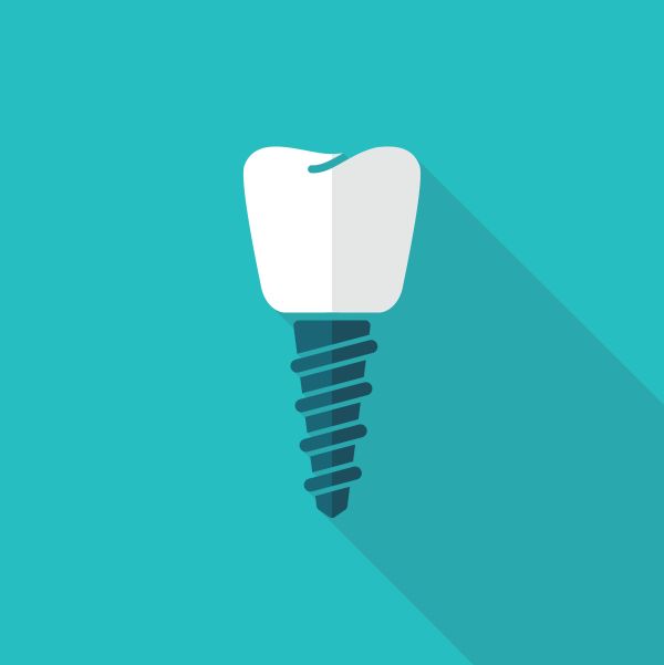 What To Ask Your Dentist About Dental Implants [Missing Teeth Replacement]