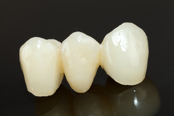 Types Of Dental Bridges And How To Choose The Right One For Your Smile