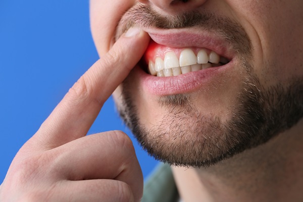 The Importance Of Periodontal Gum Disease Treatment