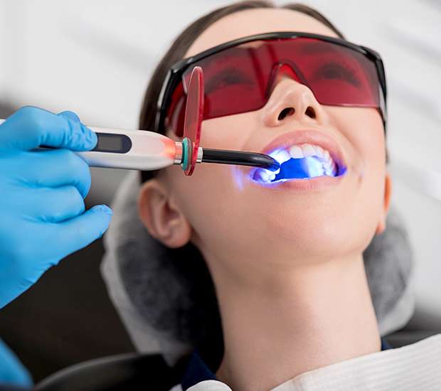 Northridge Professional Teeth Whitening